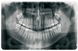 Jain Dental Hospital Raipur - Multispecialty and professional dental clinic