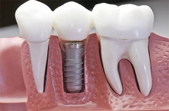 Jain Dental Hospital